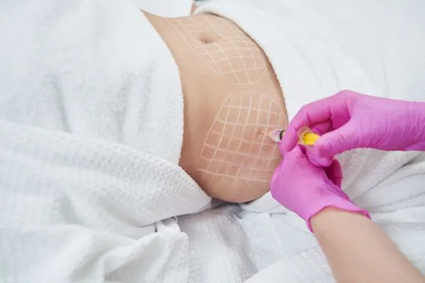 image of fat dissolving injections on love handles to help combat weight gain Leatherhead