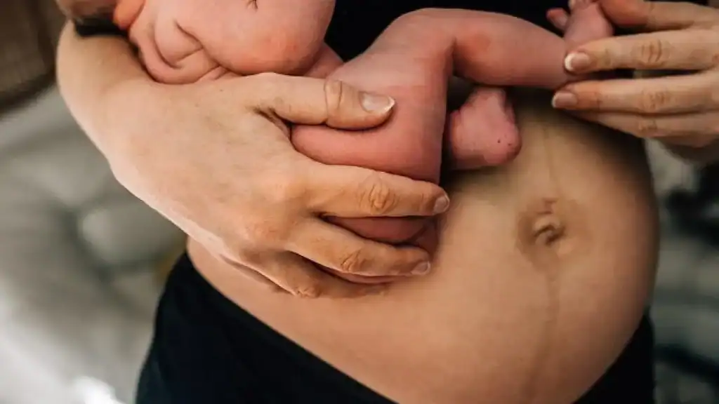 Why Is My Stomach Still Big After Pregnancy Leatherhead?